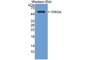 Western blot analysis of the recombinant protein. (CELA1 anticorps  (AA 40-258))