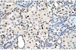 Rabbit Anti-PSME3 Antibody  Paraffin Embedded Tissue: Human Kidney Cellular Data: Epithelial cells of renal tubule Antibody Concentration: 4. (PSME3 anticorps  (N-Term))