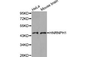 Western blot analysis of extracts of various cell lines, using HNRNPH1 antibody (ABIN5973515). (HNRNPH1 anticorps)