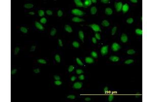 Image no. 5 for anti-Tripartite Motif Containing 33 (TRIM33) (AA 1006-1106) antibody (ABIN599250) (TRIM33 anticorps  (AA 1006-1106))