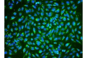 IF analysis of ALDH2 using anti-ALDH2 antibody (ABIN7603122). (ALDH2 anticorps  (N-Term))