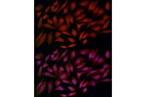 Immunohistochemistry of paraffin-embedded mouse kidney using Ferritin Heavy Chain Rabbit pAb (ABIN3021538, ABIN3021539, ABIN3021540 and ABIN6215218) at dilution of 1:100 (40x lens).