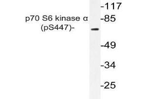 Western blot (WB) analyzes of p-p70 S6 kinase alpha antibody in extracts from A549 PMA cells. (RPS6KB1 anticorps  (pSer447))