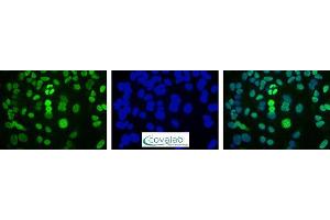 Image no. 5 for anti-DNA Repair Protein Apurinic Endonuclease antibody (ABIN5693483) (DNA Repair Protein Apurinic Endonuclease anticorps)