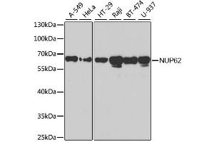 Western blot analysis of extracts of various cell lines, using NUP62 antibody. (NUP62 anticorps)