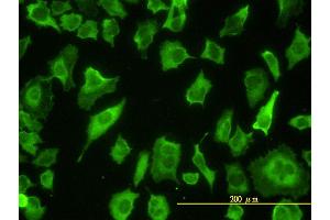 anti-Par-6 Partitioning Defective 6 Homolog beta (PARD6B) (AA 1-372) antibody