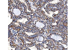 IHC analysis of Paxillin/PXN using anti-Paxillin/PXN antibody (ABIN7602636). (Paxillin anticorps  (AA 9-570))