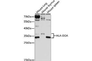 Western blot analysis of extracts of various cell lines, using HLA-DOA antibody (ABIN7267757) at 1:1000 dilution.
