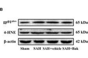 The effect of Bak on the oxidative stress 24 h after SAH. (beta Actin anticorps  (AA 1-375))