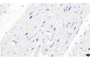 ABIN334386 Negative Control showing staining of paraffin embedded Human Heart, with no primary antibody.