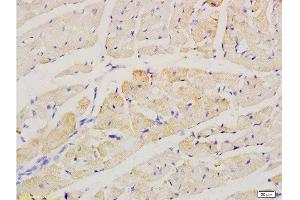 Formalin-fixed and paraffin embedded rat heart labeled with Anti-factor V Polyclonal Antibody, Unconjugated  at 1:200 followed by conjugation to the secondary antibody and DAB staining. (Factor 5 (AA 301-400) anticorps)