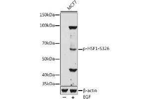 Western blot analysis of extracts of MCF7 cells, using Phospho-HSF1-S326 antibody (ABIN7267586) at 1:500 dilution.