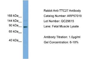 WB Suggested Anti-TTC27  Antibody Titration: 0. (TTC27 anticorps  (N-Term))