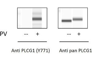 Pervanadate (PV) Stimulation of Jurkat Cell Line