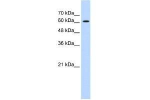 WB Suggested Anti-ZIC2 Antibody Titration:  0. (ZIC2 anticorps  (C-Term))