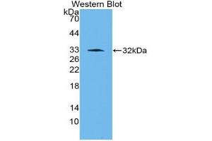 Western blot analysis of the recombinant protein. (PAI1 anticorps  (AA 141-389))