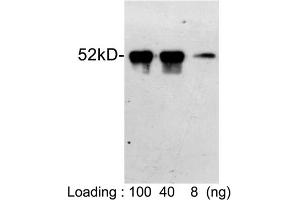 Loading: S-tag fusion protein expressed in E.