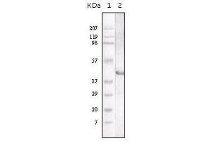 Western Blot showing LAL antibody used against LAL recombinant protein.