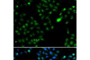 Immunofluorescence analysis of HeLa cells using FKBP3 Polyclonal Antibody (FKBP3 anticorps)