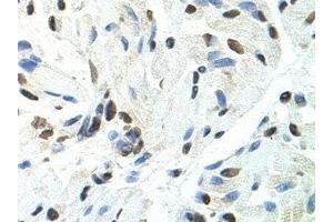 Immunohistochemistry (IHC) image for anti-Splicing Factor Proline/glutamine-Ric (SFPQ) antibody (ABIN1874752) (SFPQ anticorps)