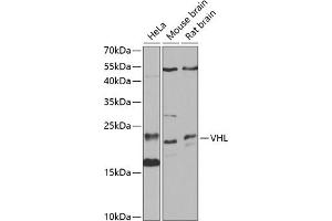 Western blot analysis of extracts of various cell lines, using VHL antibody (ABIN3020967, ABIN3020968, ABIN3020969 and ABIN6213828) at 1:1000 dilution. (VHL anticorps  (AA 1-172))