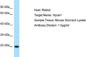WB Suggested Anti-Hpcal1 Antibody   Titration: 1.