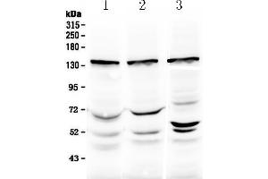 Western blot analysis of Exportin-5 using anti-Exportin-5 antibody . (XPO5 anticorps  (N-Term))
