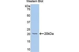 Detection of Recombinant GALC, Human using Polyclonal Antibody to Galactosylceramidase (GALC) (GALC anticorps  (AA 375-535))