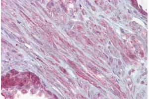 Anti-KCNMA1 antibody IHC staining of human prostate.