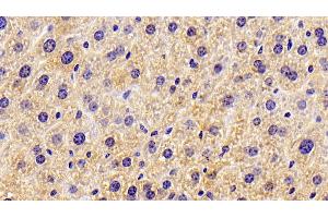 Detection of HMGCS2 in Mouse Liver Tissue using Polyclonal Antibody to Hydroxymethylglutaryl Coenzyme A Synthase 2, Mitochondrial (HMGCS2) (HMGCS2 anticorps  (AA 1-167))