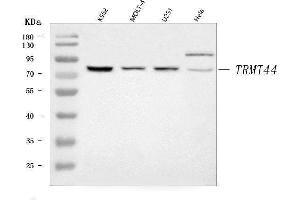 Western blot analysis of TRMT44 using anti-TRMT44 antibody (ABIN7599540).