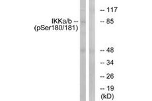 Western blot analysis of extracts from HepG2 cells treated with TNF 20ng/ml 5', using IKK-alpha/beta (Phospho-Ser180/181) Antibody. (IKK-alpha /IKK-beta anticorps  (pSer180))