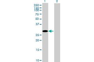 Western Blot analysis of CCS expression in transfected 293T cell line by CCS MaxPab polyclonal antibody. (Superoxide dismutase copper chaperone anticorps  (AA 1-274))