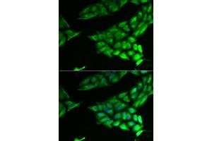 Immunofluorescence analysis of U2OS cells using PSAT1 antibody. (PSAT1 anticorps)