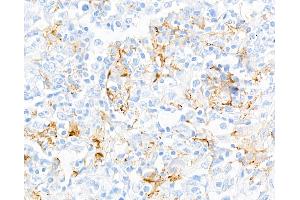 Immunohistochemistry (IHC) image for anti-Mannose Receptor, C Type 1 (MRC1) (AA 1406-1456) antibody (ABIN7455101)