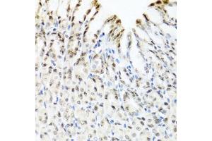Immunohistochemistry of paraffin-embedded mouse stomach using YTHDF3 antibody. (YTHDF3 anticorps)
