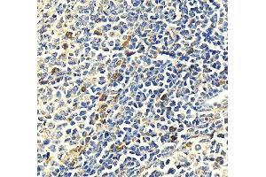 IHC analysis of MPO using anti-MPO antibody (ABIN7602030). (Myeloperoxidase anticorps  (AA 556-697))