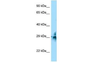 WB Suggested Anti-TMUB2 Antibody Titration: 1. (TMUB2 anticorps  (C-Term))