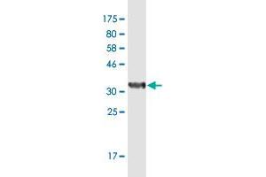 Western Blot detection against Immunogen (36. (SUPT4H anticorps  (AA 18-117))