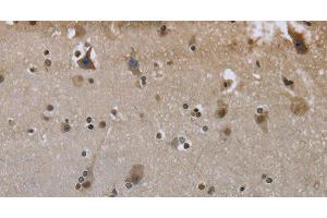 Immunohistochemistry of paraffin-embedded Human brain using GYS1 Polyclonal Antibody at dilution of 1:50 (Glycogen Synthase 1 anticorps)