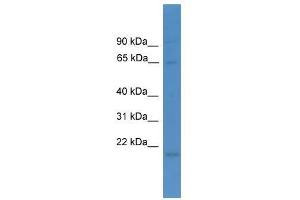 Western Blot showing LTA4H antibody used at a concentration of 1-2 ug/ml to detect its target protein. (LTA4H anticorps  (N-Term))