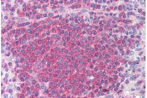 Human Spleen (formalin-fixed, paraffin-embedded) stained with CHEK2 antibody ABIN213892 at 10 ug/ml followed by biotinylated anti-mouse IgG secondary antibody ABIN481714, alkaline phosphatase-streptavidin and chromogen. (CHEK2 anticorps)