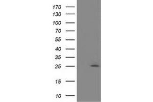 Western Blotting (WB) image for anti-Adenylate Kinase 3 (AK3) antibody (ABIN1496519) (Adenylate Kinase 3 anticorps)