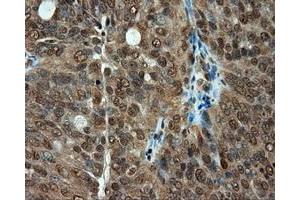 Immunohistochemical staining of paraffin-embedded colon tissue using anti-PSMC3 mouse monoclonal antibody. (PSMC3 anticorps)