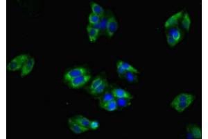 Immunofluorescent analysis of HepG2 cells using ABIN7147915 at dilution of 1:100 and Alexa Fluor 488-congugated AffiniPure Goat Anti-Rabbit IgG(H+L)