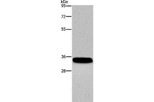 Western Blot analysis of Human normal lung tissue using CA4 Polyclonal Antibody at dilution of 1:300 (CA4 anticorps)