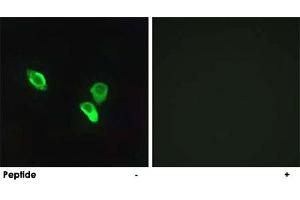 Immunofluorescence analysis of MCF-7 cells, using MRPS18C polyclonal antibody . (MRPS18C anticorps)