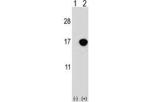 Western blot analysis of CDKN2B antibody and 293 cell lysate either nontransfected (Lane 1) or transiently transfected (2) with the CDKN2B gene. (CDKN2B anticorps  (AA 102-130))