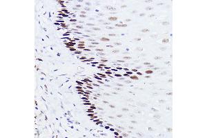 Immunohistochemistry of paraffin-embedded human esophageal using p73 Rabbit mAb (ABIN1678945, ABIN1678944, ABIN7101487 and ABIN7101488) at dilution of 1:100 (40x lens). (Tumor Protein p73 anticorps)