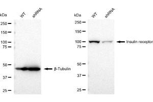 Western blotting analysis using Insulin receptor antibody (ABIN7799045). (Recombinant Insulin Receptor anticorps)
